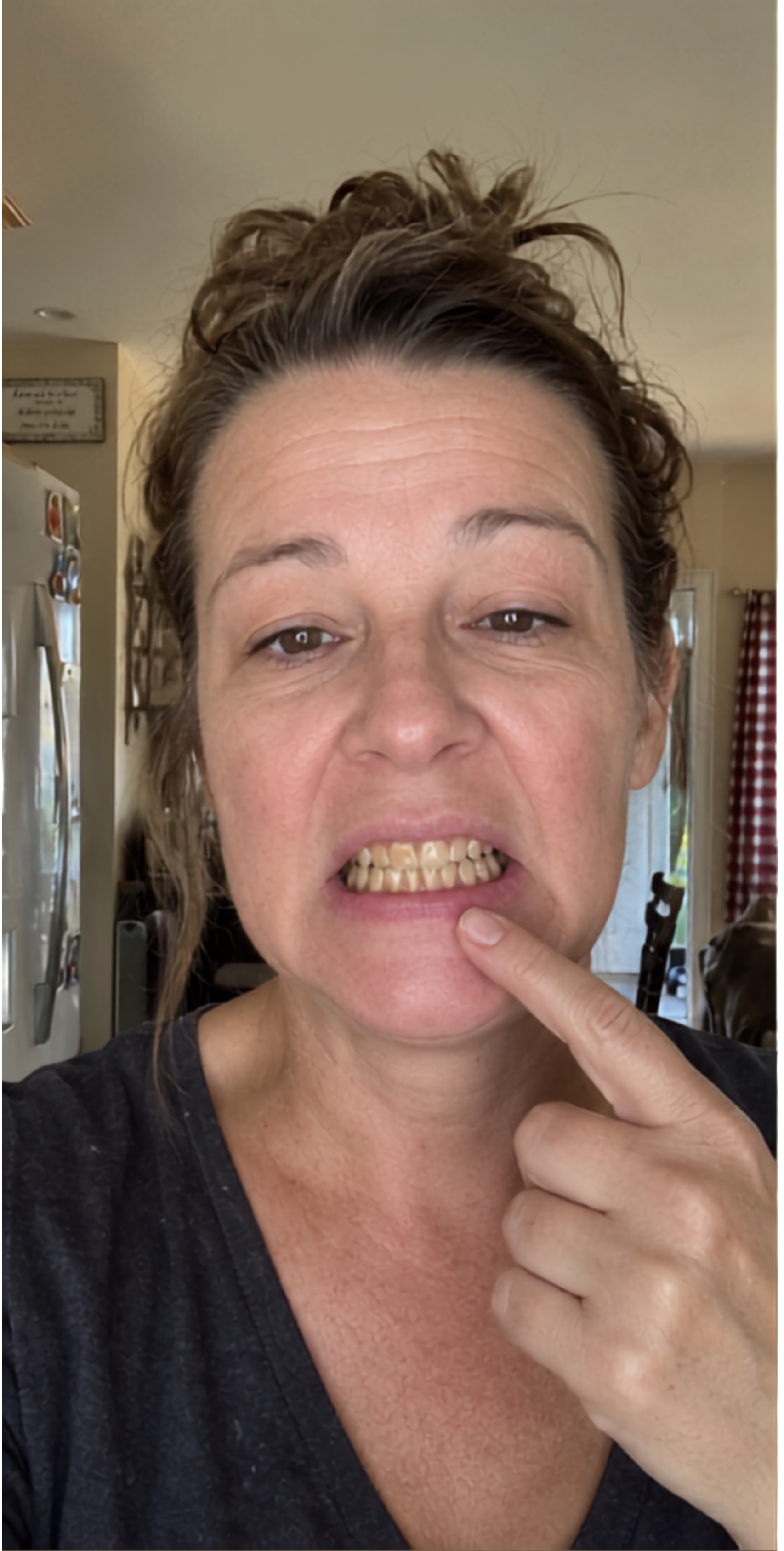 Lisa Carter at the beginning of her OralVita routine