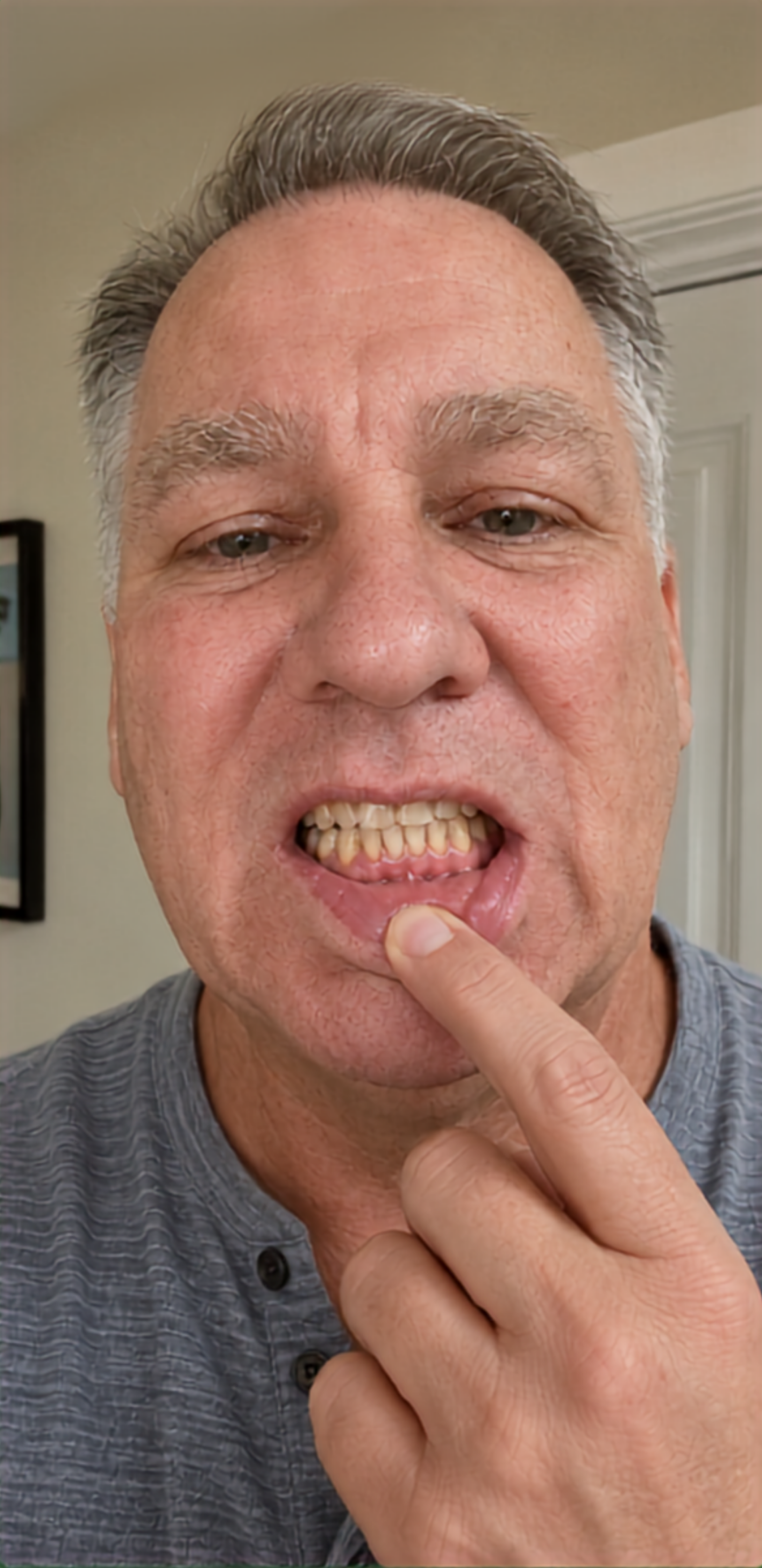 Mark Thompson at the beginning of his OralVita routine